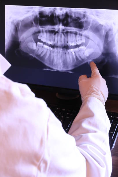 Best Emergency Tooth Extraction in Germantown, WI